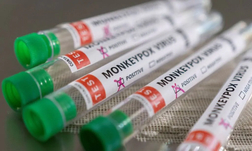Valparaiso de Goiás registra primeiro caso suspeito de Varíola dos Macacos (Monkeypox)